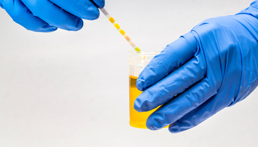 Que faire si ma bandelette urinaire se montre positif aux protéines ?