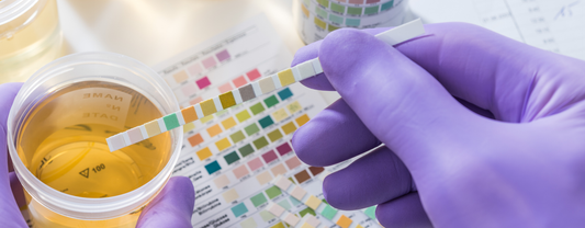personne qui sort une bandelette de test urinaire d'un pot